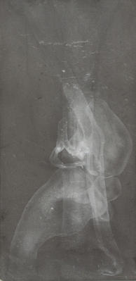Untitled, From The X-Ray Series